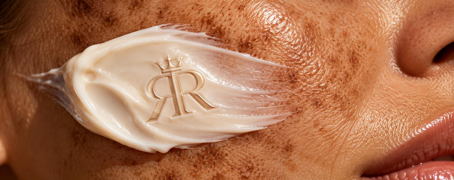 Royal Relax Bestseller Hyperpigmentierung